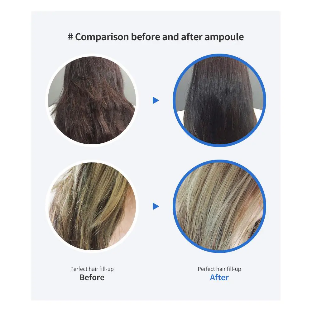 Hair Fill-Up Before and After Comparison