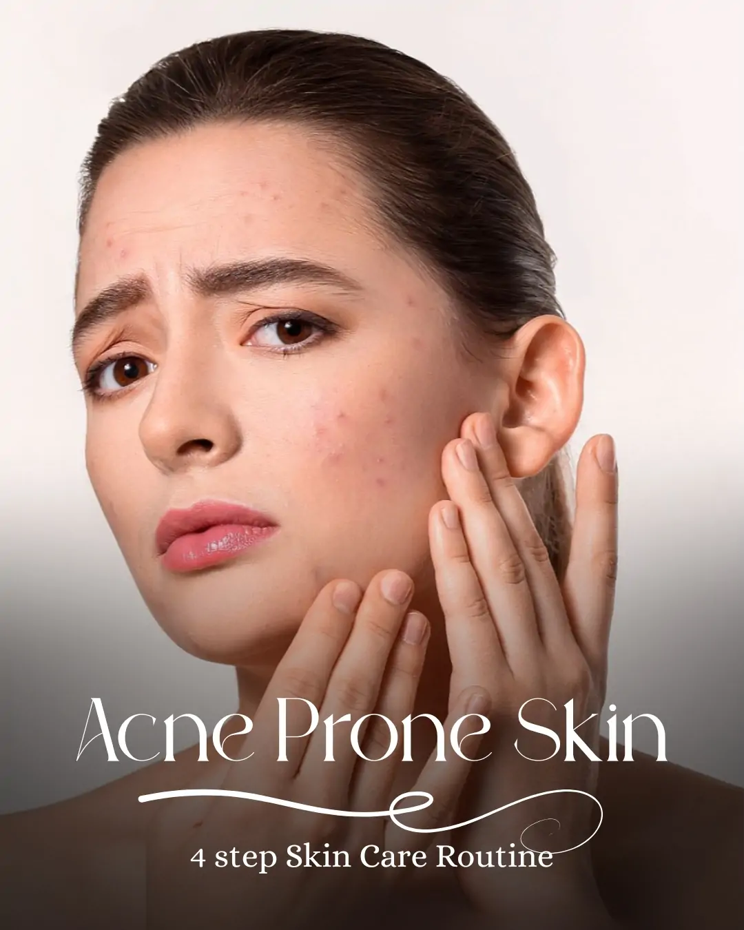 Acne_proneskin_k-beautyskin